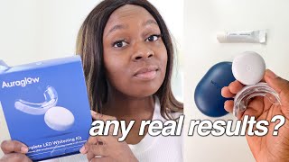 how to whiten teeth at home my honest auraglow teeth whitening review [upl. by Annaeiluj34]