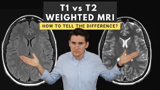 T1 vs T2 weighted MRI images How to tell the difference [upl. by Fidelio]