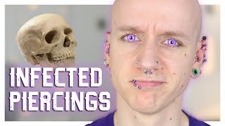 Infected Piercings amp How To Heal Them  Piercing FAQ 21  Roly [upl. by Mayeda139]