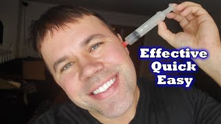 How To Remove Ear Wax Safely at Home [upl. by Aerised]