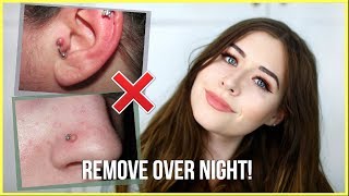 How To Get Rid Of Piercing Bumps OVERNIGHT [upl. by Emmerich]