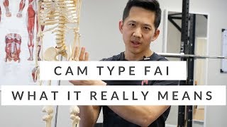 Cam Hip Impingement  What You Need to Know about FAI [upl. by Kampmann177]