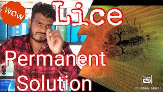 The Best Way to Remove Lice Honest RobiComb Review [upl. by Ulla598]