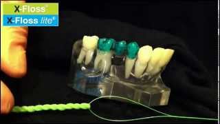 Hygienist shows how to floss IMPLANTS and BRIDGES [upl. by Odrick]