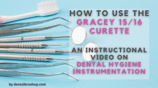 How to use the Gracey 1516 Curette [upl. by Kroll754]