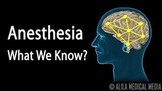 ANESTHESIA UNNATURAL MOVEMENTS How Anesthesia Gas Works  Anesthesiologist answers [upl. by Otti]