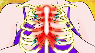 How to get rid of Costochondritis Pain in just 3 minutes [upl. by Orji612]