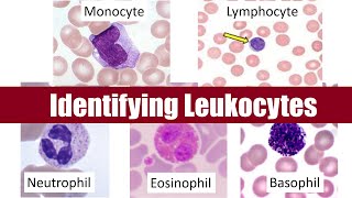 Identifying Leukocytes [upl. by Htabmas]