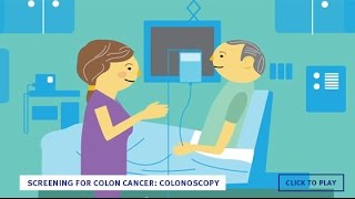 Screening for Colon Cancer Colonoscopy English [upl. by Anitselec]