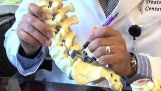 Surgical Procedures  Lumbar Laminectomy amp Discectomy [upl. by Pilif]