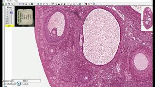 Stratified cuboidal epithelium [upl. by Anohs]