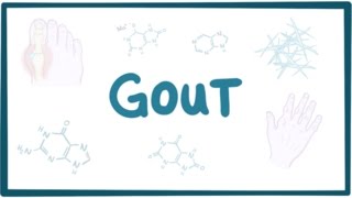 Gout  causes symptoms diagnosis treatment pathology [upl. by Nurat]