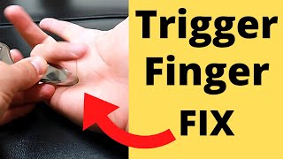 FIX Trigger Finger in 5 Minutes 3 Steps [upl. by Cybil564]