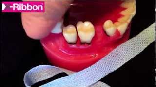 Hygienist shows how to floss PERIO teeth and IMPLANTS [upl. by Lozano]