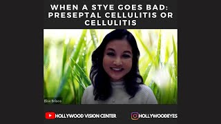 When a Stye Goes Bad Preseptal Cellulitis or Cellulitis [upl. by Medlin]