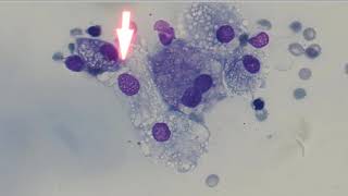 5 Minute Rounds Salivary mucocele ranula [upl. by Goss206]