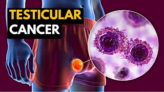 How to Prevent Testicular Cancer  Testicular Cancer [upl. by Colligan]