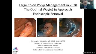 Large Colon Polyp Management in 2020 The Optimal Waye to Approach Endoscopic Removal [upl. by Lampert892]