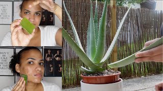 HOW TO USE ALOE VERA TO CLEAR ACNE amp DARK SPOTS [upl. by Ynej]