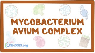 Mycobacterium avium complex  causes symptoms diagnosis treatment pathology [upl. by Dilaw905]