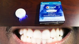 How To Whiten Teeth Easy • AuraGlow LED Light amp Crest 3D Whitestrips [upl. by Einneb42]