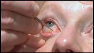 Oculoplastics basic exam Lacrimal system examination [upl. by Nivrad]