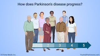 Parkinsons Disease Exercises Balance [upl. by Talich]