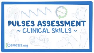 Clinical Skills Pulses assessment [upl. by Veneaux]