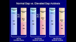 ABG Interpretation The Anion Gap Lesson 5 [upl. by Flip96]