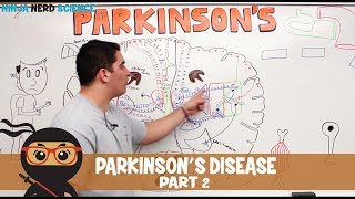 My Parkinson’s Story Pain [upl. by Eladnyl196]