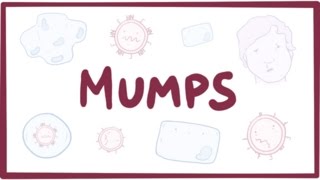 Mumps  symptoms diagnosis treatment pathology [upl. by Aylmar172]