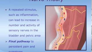 Understanding Interstitial Cystitis ICPainful Bladder Syndrome PBS [upl. by Assillim]