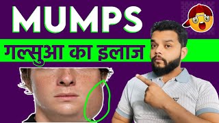 Mumps Causes Symptoms Treatment  Mumps [upl. by Siulegroj]