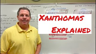 Xanthoma A Simple Explanation [upl. by Bridgid785]