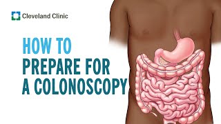 Tips to Prepare for Your Colonoscopy [upl. by Alic]