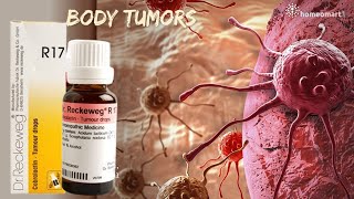 Shrink Tumors Naturally Unveiling Dr Reckewegs R17 Homeopathy Drops [upl. by Ashla]