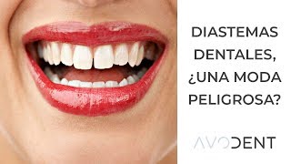 Diastemas ¿cómo corregir los dientes separados  Clínica dental Avodent en Alcobendas [upl. by Lorie]