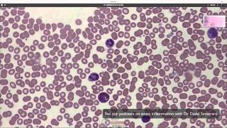 What blood looks like down the microscope [upl. by Skye]