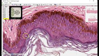 Keratinized stratified squamous epithelium [upl. by Nylesoy]