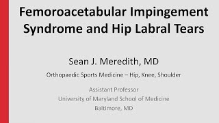 Femoroacetabular Impingement Syndrome and Hip Labral Tears [upl. by Tacye]