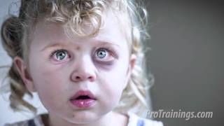 Recognition of Child Abuse and Neglect Training Video [upl. by Anica]