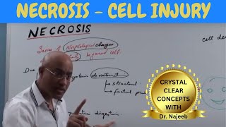 Necrosis  Cell Injury  General Pathology 🩺 [upl. by Caffrey]