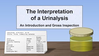 Interpretation of the Urinalysis Part 1  Introduction and Inspection [upl. by Aslam]