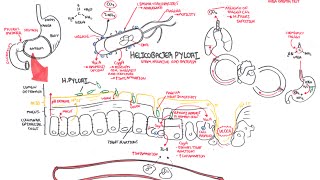 Microbiology  Helicobacter Pylori Ulcer [upl. by Haila377]