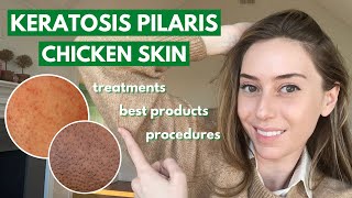 HOW TO GET RID OF STRAWBERRY LEGS IN ONE DAY Get Rid Of Keratosis Pilaris And Dark Spots On Legs [upl. by Vevina]